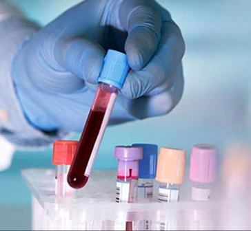 CÁC TIÊU CHÍ ĐÁNH GIÁ THƯỜNG GẶP TRONG CÁC THỬ NGHIỆM LÂM SÀNG BỆNH UNG THƯ