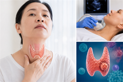 TIẾP CẬN CHẨN ĐOÁN VÀ QUẢN LÝ BỆNH NHÂN CÓ NHÂN TUYẾN GIÁP